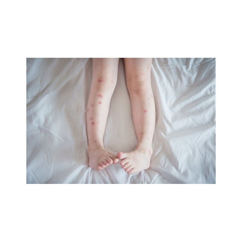   Mleczko repelent Mugga 20,5% DEET 50 ml - 10 - Środki na komary i kleszcze